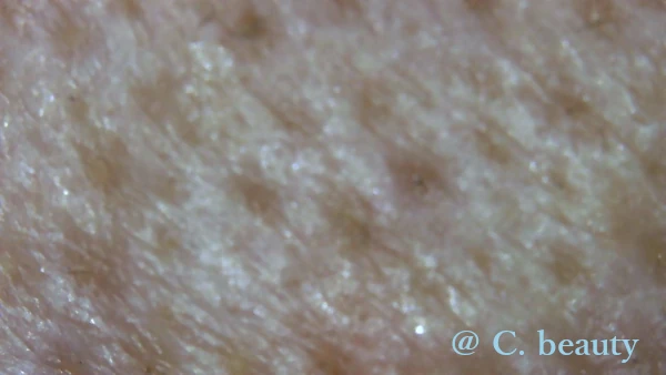 セラム美容液使用後の毛穴画像